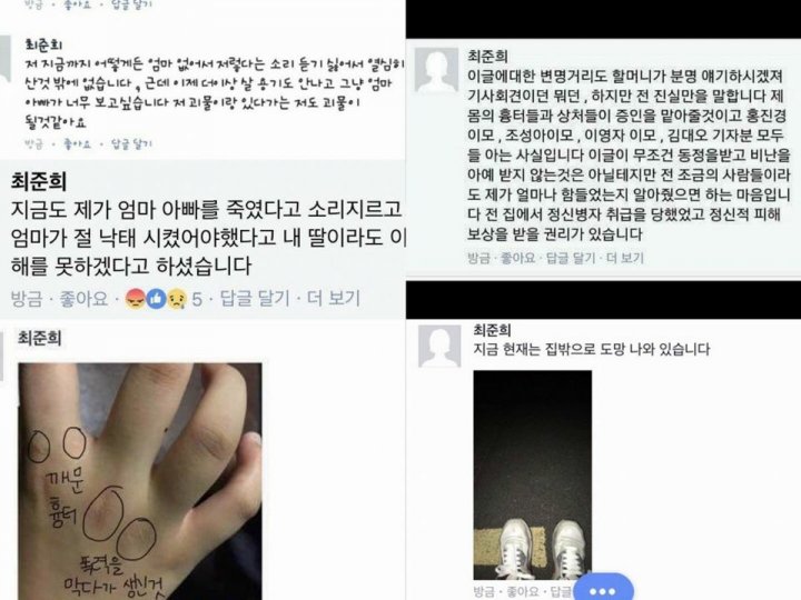 최준희 추가 폭로…폭행사진 공개 “전 진실만을 말한다”