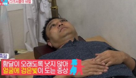 김수용 흑달 진단? ‘흑달이 뭐길래’...“심각한 상태”