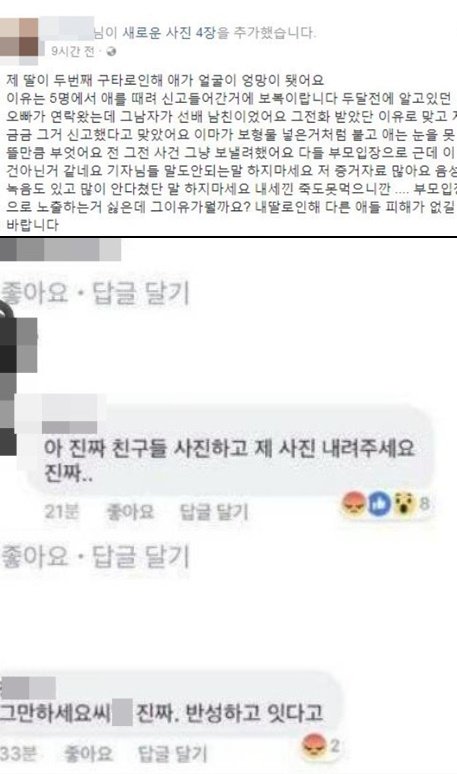 ‘부산 여중생 폭행 사건’ 피해자는 눈도 못 뜨고 가해자는 적반하장