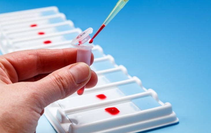 치매, 혈액 검사로 조기 진단…국내 기술 상용화 수순