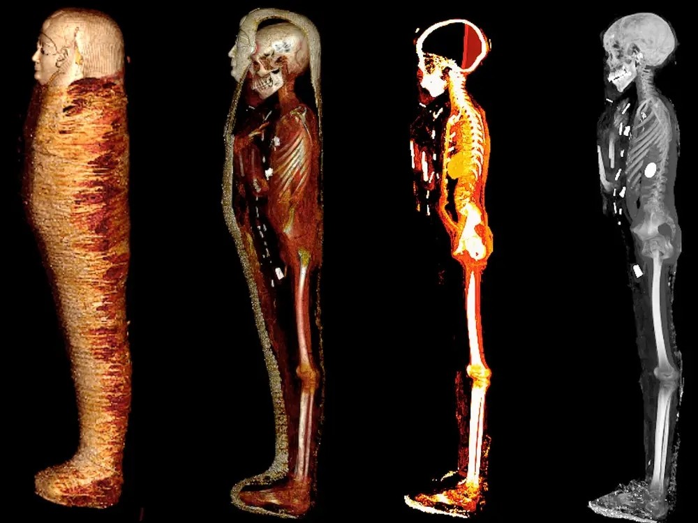 카이로 대학 고고학 팀이 촬영한 2300여년 전 제작된 미라 관 CT 사진. 사진=사하라 살림 카이로대 교수 연구팀.