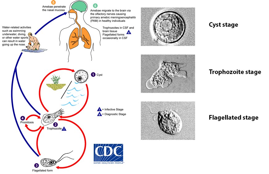 파울러자유아메바 생활사(왼쪽)와 여러 형태의 파울러자유아메바. (오른쪽 위부터 아래로) 피낭 단계, 영양체 단계, 편모충 단계. 사진=미국질병예방센터(CDC)