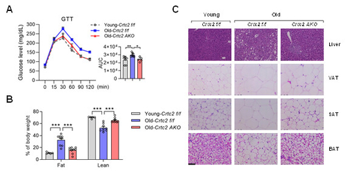 노화 및 Crtc2 지방세포 특이적 결손에 따른 대사표현형 이미지