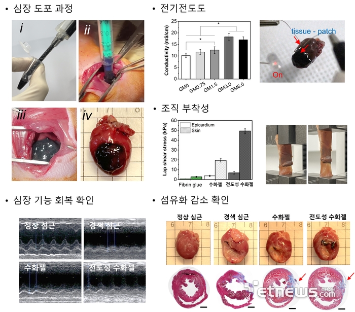 수화젤 심근 패치의 도포성, 전기전도성, 조직 부착성, 심장 기능 회복과 섬유화 감소 확인 결과.