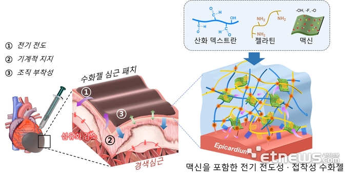 심장에 바를 수 있는 전기전도성·접착성 수화젤 심근 패치 모식도.