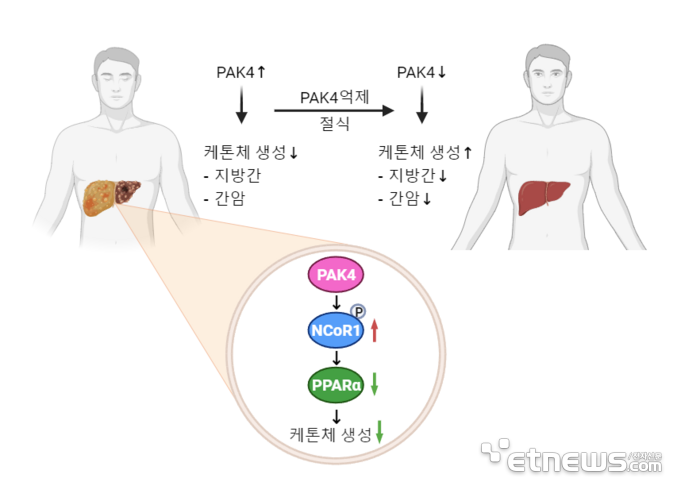 PAK4 단백질 억제에 의해 케톤체생성이 증가해 지방간과 간암 완화된다는 연구 내용.