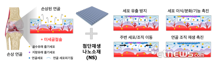 첨단재생소재를 활용한 무릎연골재생 촉진 기술및 메커니즘.