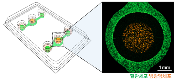 3차원 생체칩 이미지. 혈관과 암세포의 시간차 배양이 가능하고 샘플 회수와 분석이 용이하다. (사진=분당서울대병원)