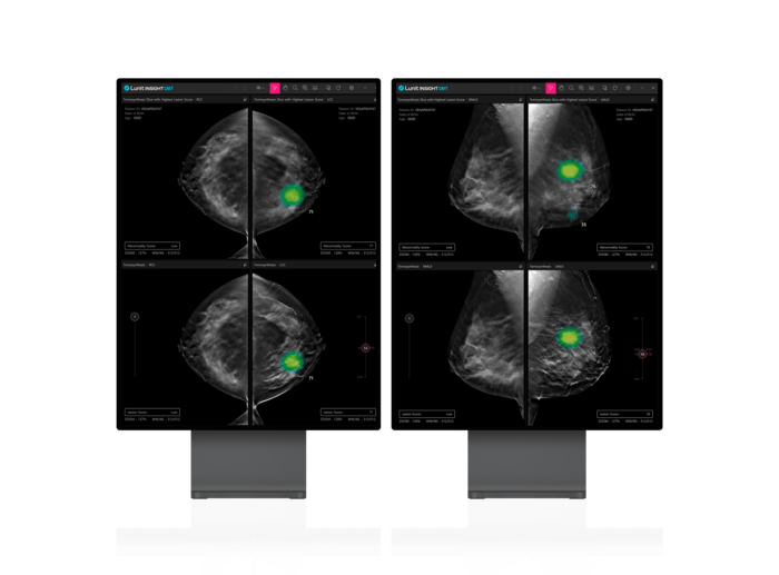 루닛, 3D 유방암 검진 '루닛 인사이트 DBT' 美 FDA 승인 획득