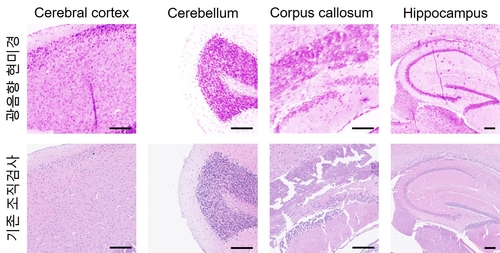 쥐의 뇌 조직을 이용한 조직학적 영상 비교