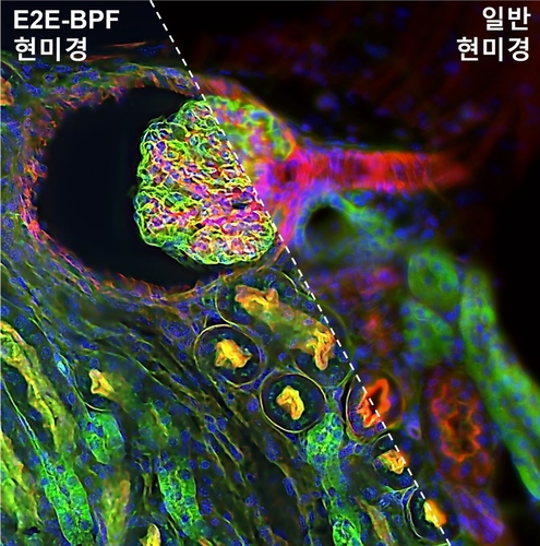 E2E-BPF 현미경과 일반 현미경 비교도. 사진=주철민 연세대 교수