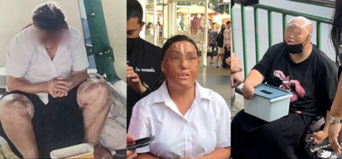최근 태국에서 신체 일부가 심하게 훼손된 중국 걸인들이 잇따라 포착돼 논란이다. 사진=트위터 캡쳐