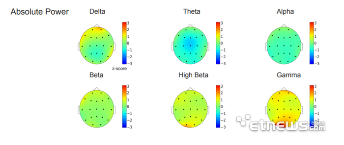 마인드스캔 결과지 일부