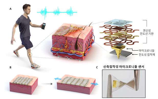 신축 접착성 마이크로니들 센서 개념도와 실제 센서 모습.