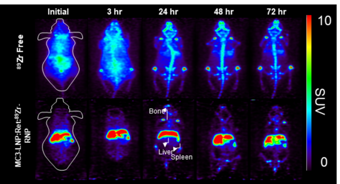Zr-89와 합성한 크리스퍼 단백질이 간경화 질환을 앓는 쥐에 투여된 후 72시간 동안을 추적한 영상자료.