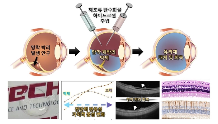 해조류 유래 천연 탄수화물 생체소재를 기반으로 한 망막 박리 치료용 하이드로젤 이미지