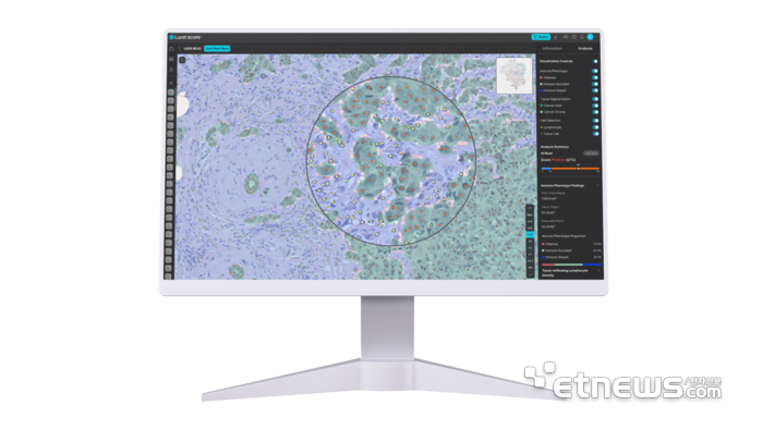 루닛 “27개 암종에서 AI로 면역항암제 치료효과 예측 가능”…美 SITC 논문 게재