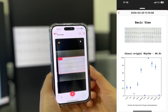 전도 검사 결과 이미지를 스마트폰으로 촬영(왼쪽)하면 인공지능모델이 이를 분석해 응급질환 판단을 지원(오른쪽)한다.