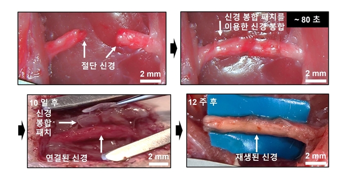 신경 봉합 패치의 봉합 과정 및 성능. 손동희 성균관대 교수 제공