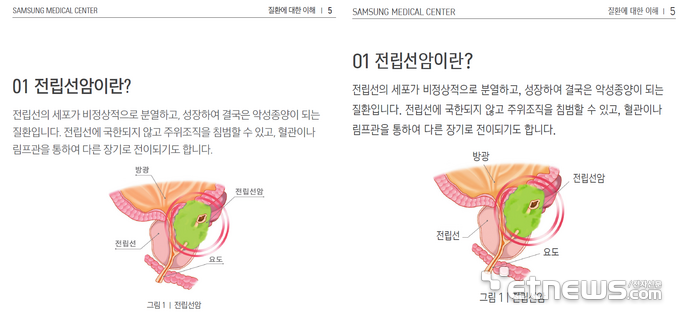 디올폰트 적용 전(왼쪽)과 후