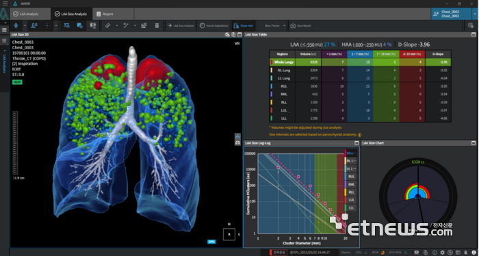 코어라인소프트 만성폐쇄성폐질환(COPD) 분석 자동화 SW '에이뷰 씨오피디'