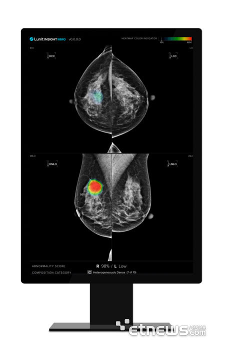루닛 유방촬영술 AI 영상분석 솔루션 '루닛 인사이트 MMG' (제공=루닛)