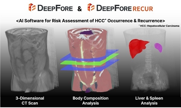 메디컬아이피, HIMSS 2024 Europe서 DeepFore(딥포어), DeepFore Recur(딥포어 리커) 시연. 사진=메디컬아이피