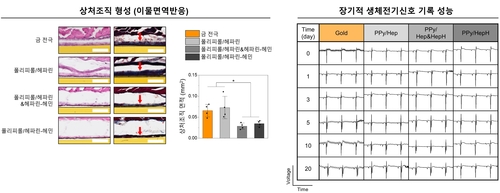 이물면역반응의 효과적 완화 및 장기 안정적 심전도 기록 성능 확보.