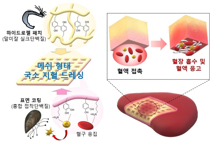 말미잘과 홍합 단백질을 활용한 건조 하이드로젤 메쉬 형태의 흡수성 국소 지혈 드레싱