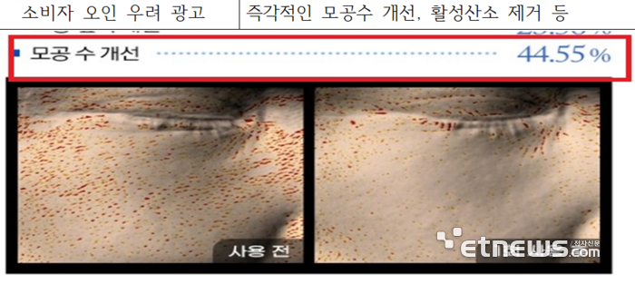 마이크로니들 과대광고