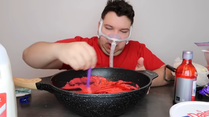 미국 먹방 유튜버 체중감량 전. 사진=니코카도 아보카도 유튜브 캡처