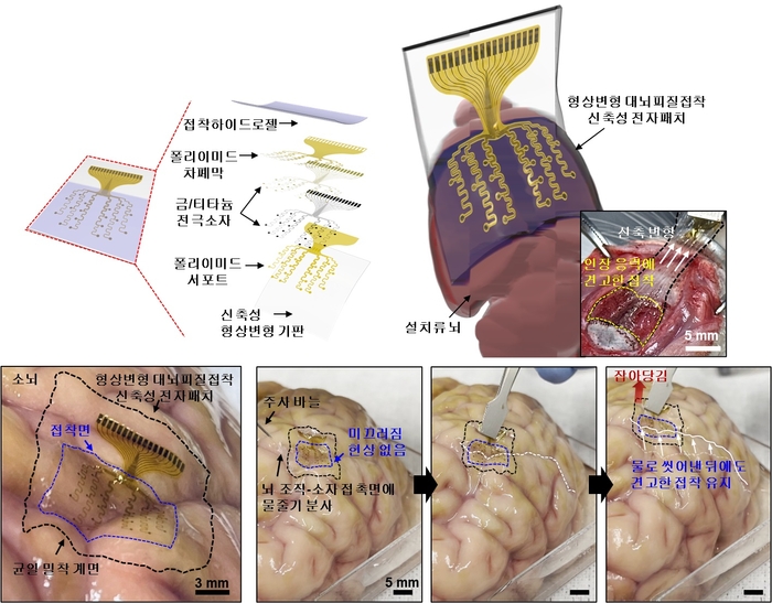 형상변형 대뇌피질접착 신축성 전자패치 개요