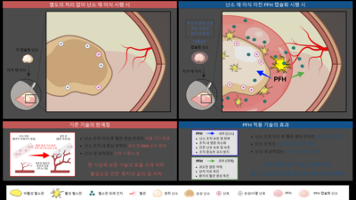 기사 썸네일