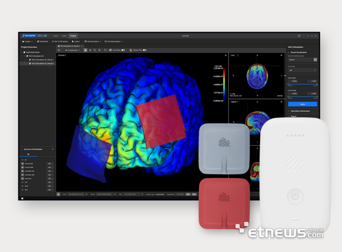 혁신의료기기 지정 뉴로핏 잉크(개인 맞춤형 tDCS 솔루션)