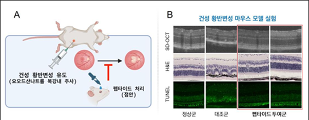 건성 황반변성마우스 모델에서의 펩타이드 치료 효능