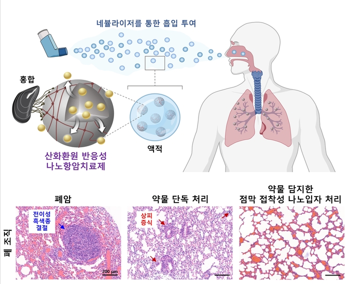 홍합 접착단백질 기반의 흡입형 점막 접착성 나노항암치료제 모식도(위)와 폐암 동물 모델에서의 치료 결과(아래)