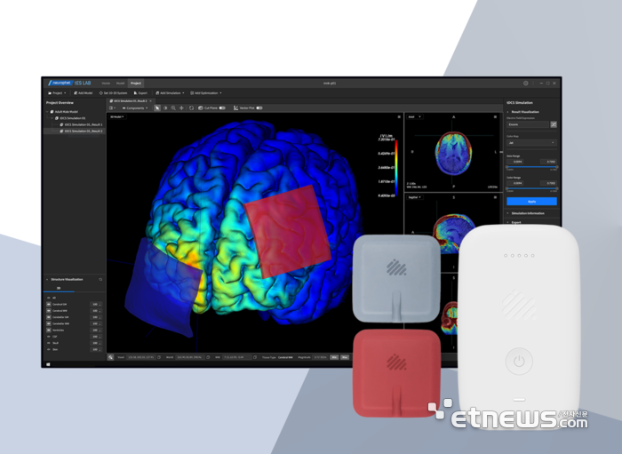 개인 맞춤형 tDCS 솔루션과 뉴로핏 테스랩 및 뉴로핏 잉크 이미지