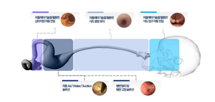 서울대병원이 구상한 AI 자율제어 내시경(자료=서울대병원)
