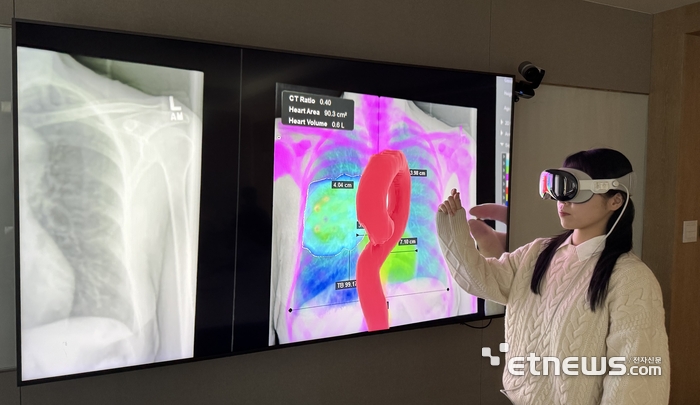 엔비디아가 찜한 '메디컬아이피', AI 기반 의료 디지털트윈-비전프로 연동 기술 공개