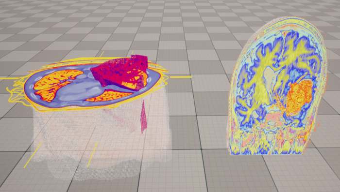 초실감 3D 장기 모델링 예시.
