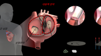 기사 썸네일