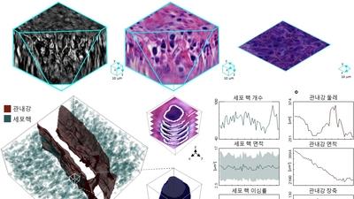 기사 썸네일