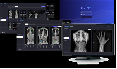 신라시스템의 다중 골격계 질환 진단 및 예후 예측 AI 솔루션(Pine-DX) 이미지