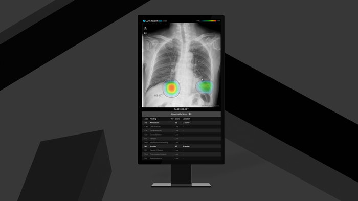 루닛 흉부 엑스레이 AI 영상분석 솔루션 '루닛 인사이트 CXR'(사진=루닛)