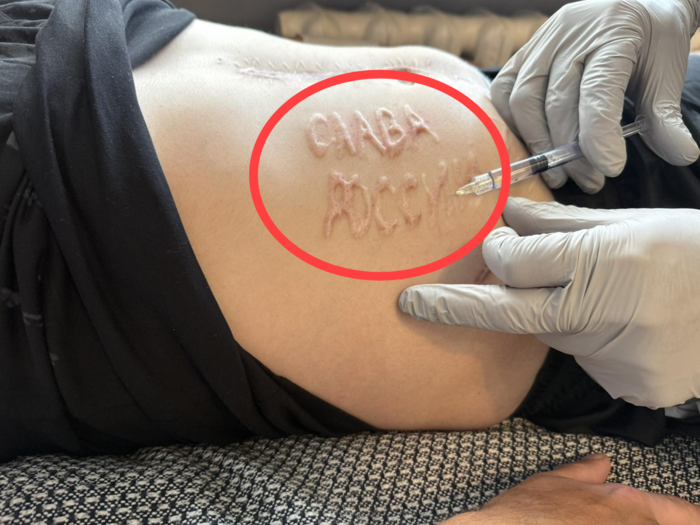 러가 석방한 우크라 군인 몸에… '러시아에 영광을' 낙인 찍혔다