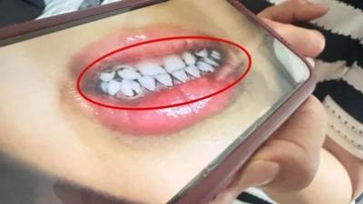 기사 섬네일