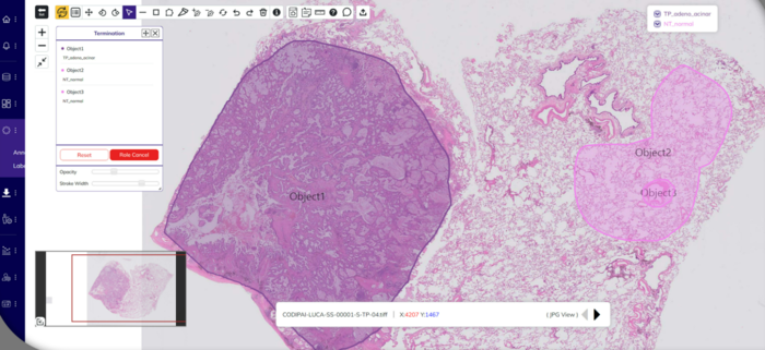 어반데이터랩, 25억 시리즈A 투자 유치...디지털 병리 생태계 속도↑ - 뉴스 썸네일 이미지