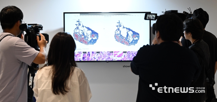 [포토] LG 정밀의료 AI모델 '엑사원 패스 2.0'