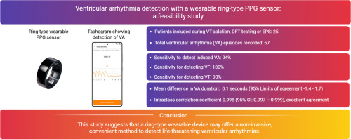 스카이랩스 '카트원', 심실 부정맥 94% 감지…국제학술지 게재