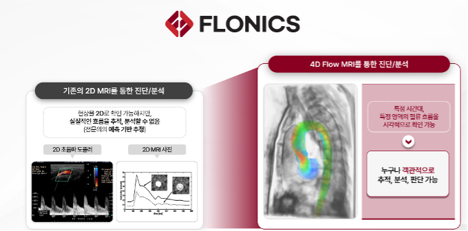 의료 영상 분석 SW 개발 플로우닉스, 10억 시드 투자 유치...카카오벤처... - 뉴스 썸네일 이미지
